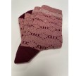 Decoy ankle sock glitter